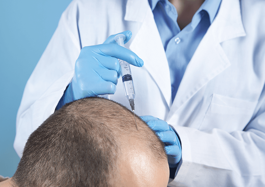 Perkütan Saç Ekimi